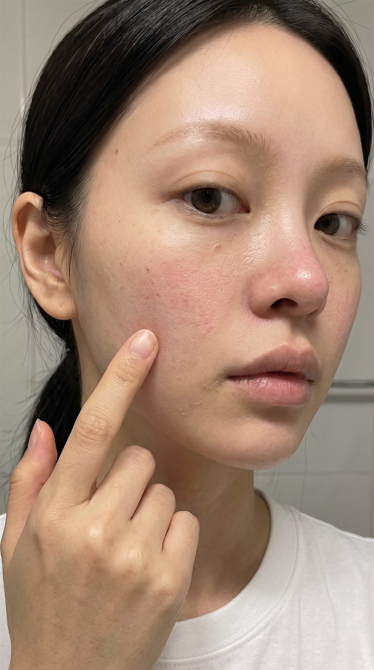 피부결과 미세한 붉은기가 보이는 HEZZ 피부 클로즈업